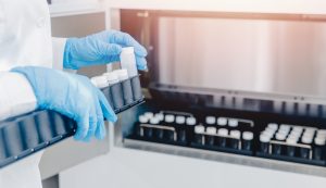 Recent Research Confirms Low Male Sperm Count Connected to Mobile Phone Use