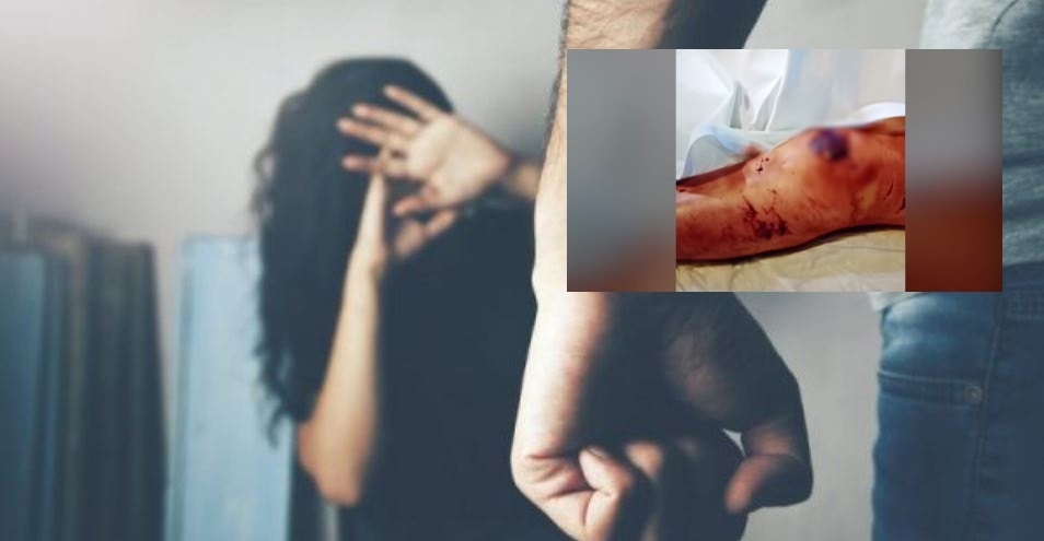 Possible ‘Loophole’ Allows Bail for Alleged Rape, Battery Suspect