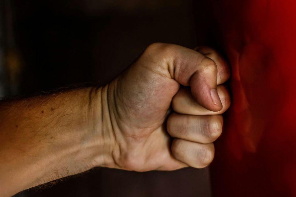 Teen Left With Broken Jaw in Violent Fight