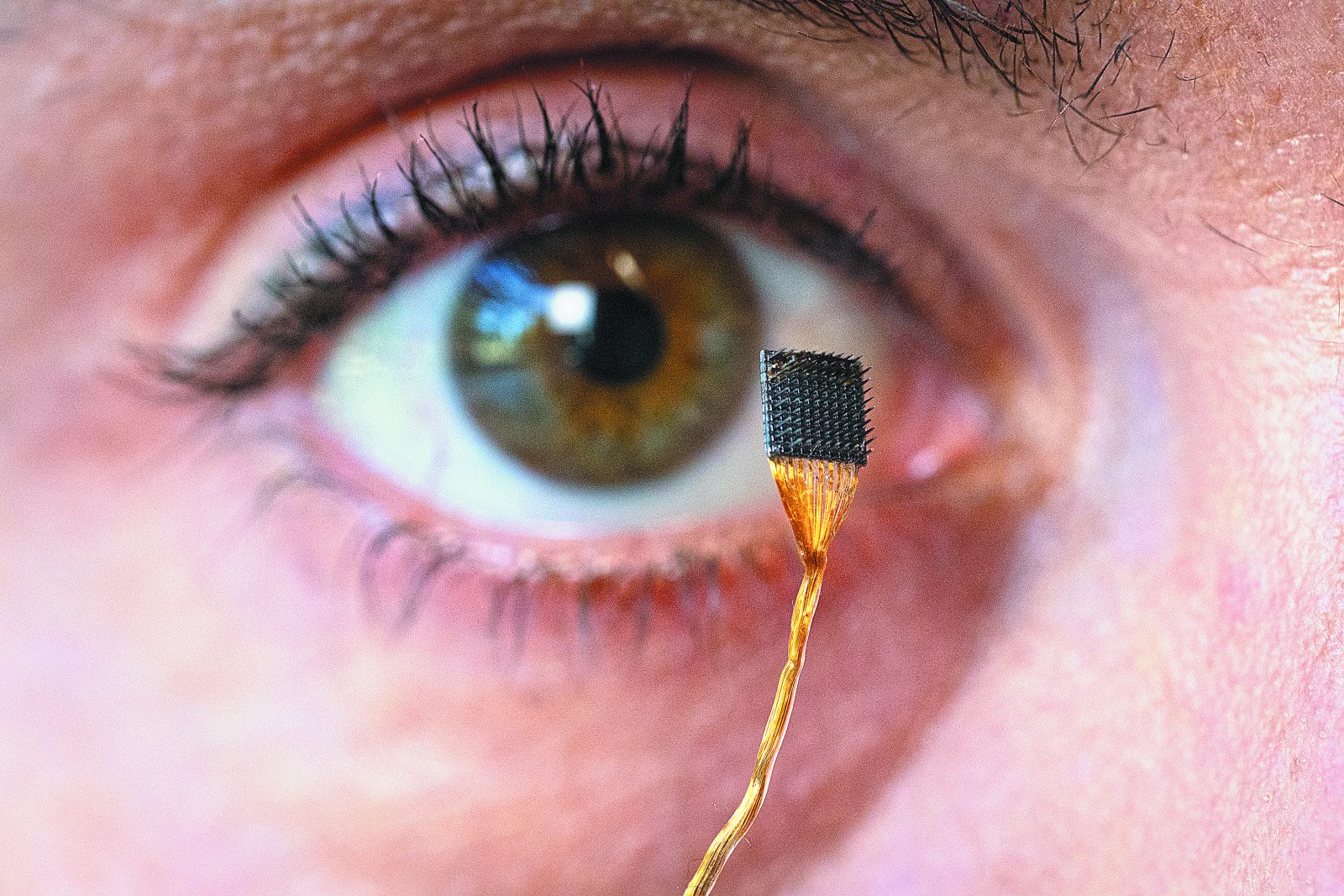 New Device Translates Thoughts Into Speech