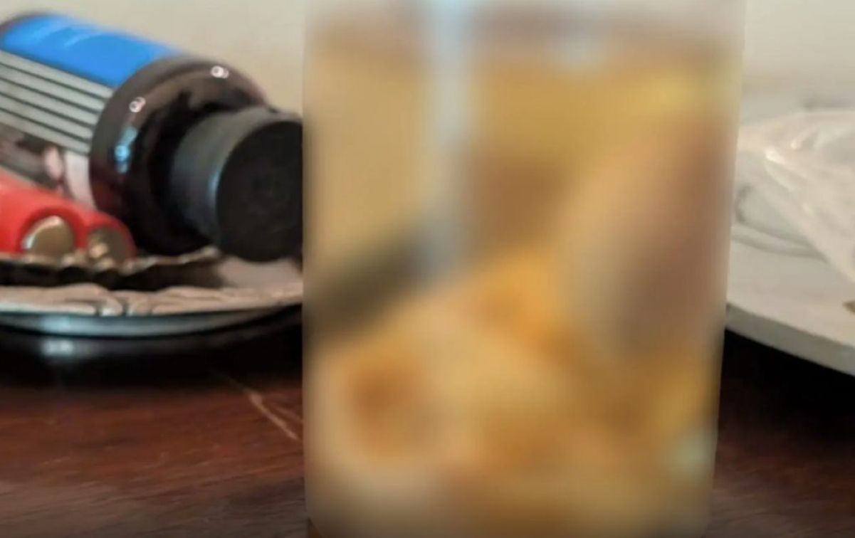 antiquities smuggling fetus