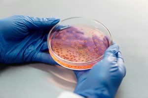 WHO Warns of Deadly Drug-Resistant Microbes