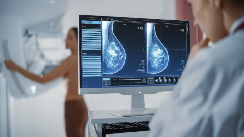 Double Mastectomy Case Referred to Greece’s Supreme Court