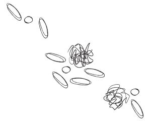 Millions of Kids Are on ADHD Pills. For Many, It’s the Start of a Drug Cascade.