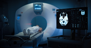 Lack of Equipment Delays and Raises the Cost of Radiotherapy