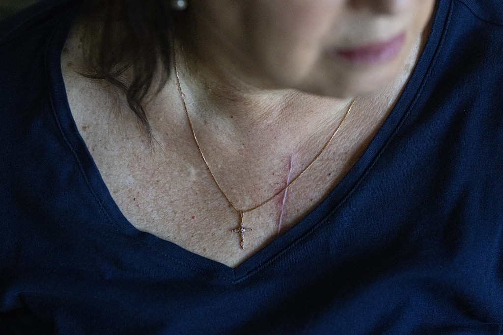 ​A Breakthrough Heart Procedure Comes With Risky Tradeoffs