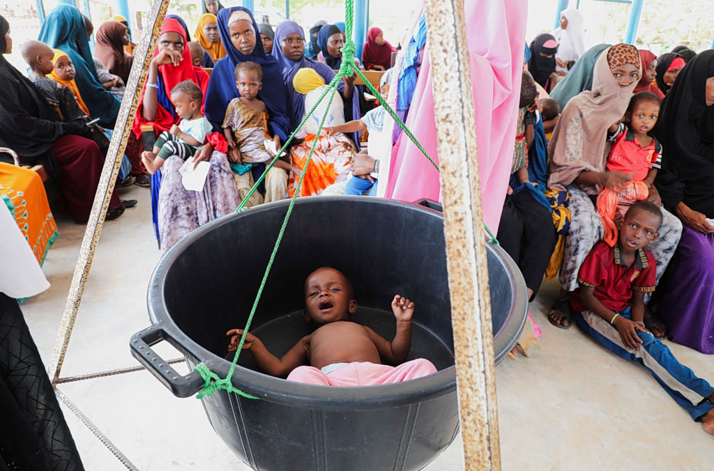 Somalia’s Malnourished Children Hit by Iran War Disruptions