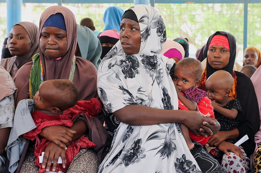 Somalia’s Malnourished Children Hit by Iran War Disruptions