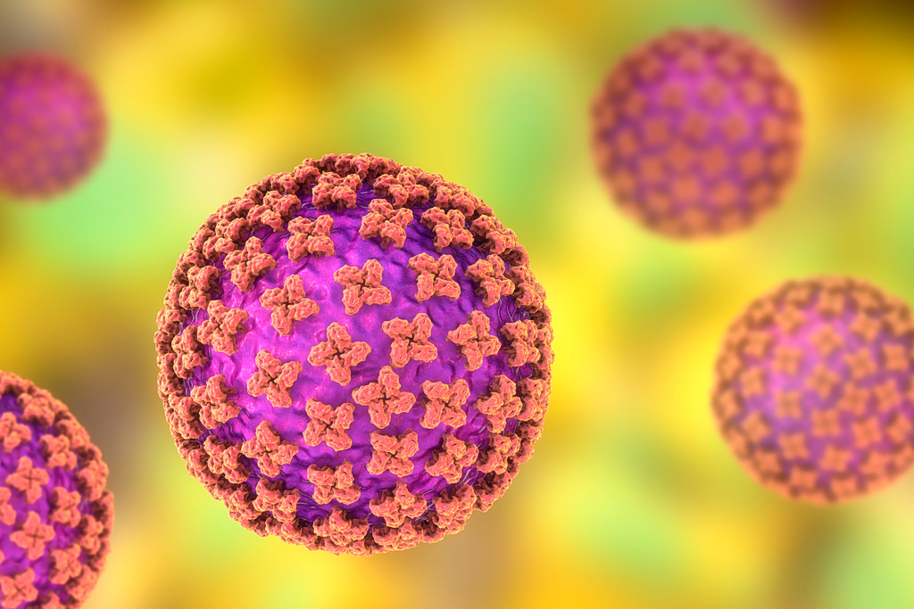 Hantavirus Infected Swiss Man Hospitalized