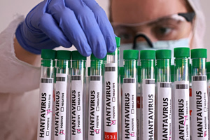 WHO: Hantavirus Outbreak on Cruise Ship ‘Not Covid’
