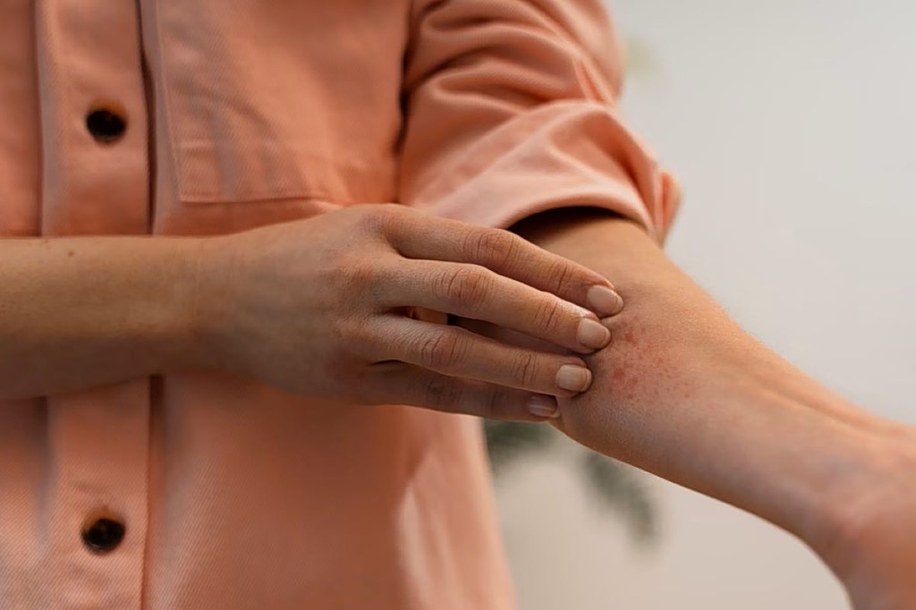 Tick Season: Rising Summer Health Risks & Prevention