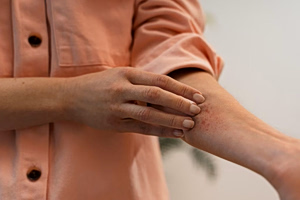 Tick Season: Rising Summer Health Risks & Prevention