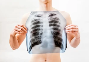 Greek Scientist Cracks the Mystery of Deadly Lung Disease