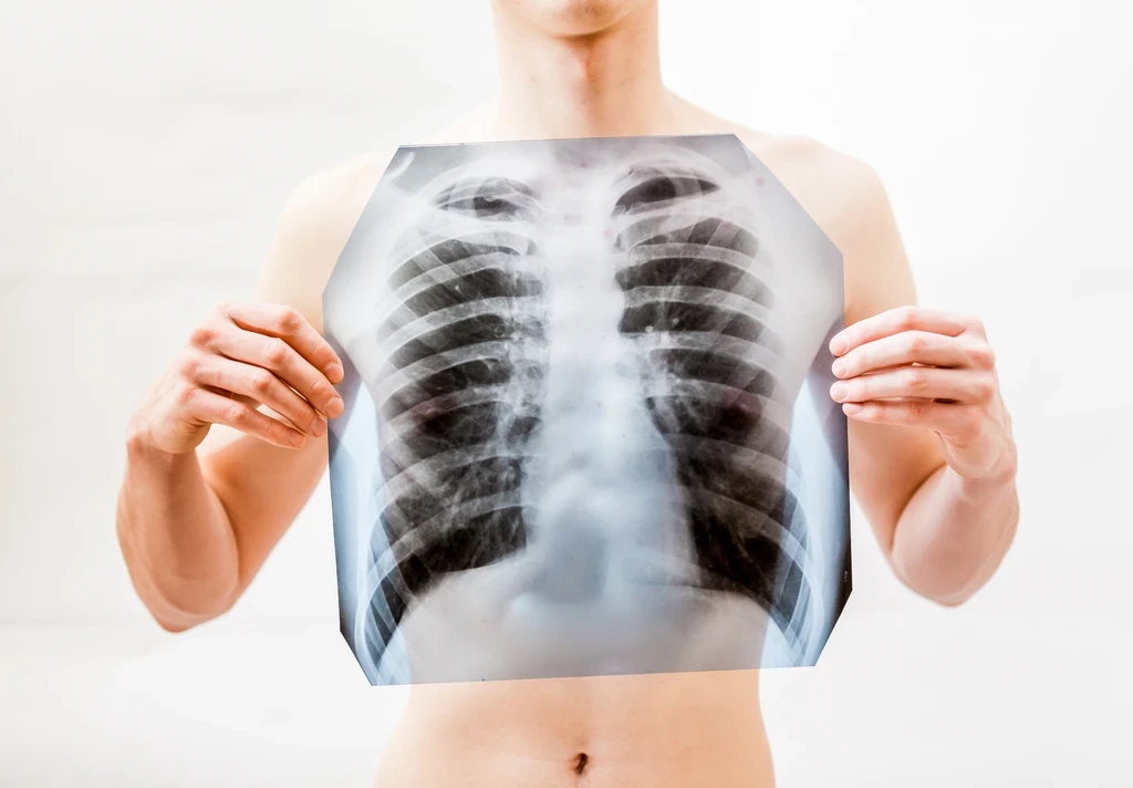 Greek Scientist Cracks the Mystery of Deadly Lung Disease