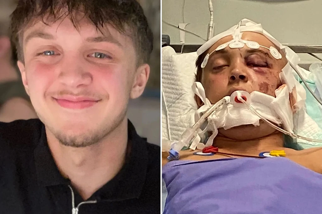 British Tourist in Critical Condition After Zakynthos ATV Crash