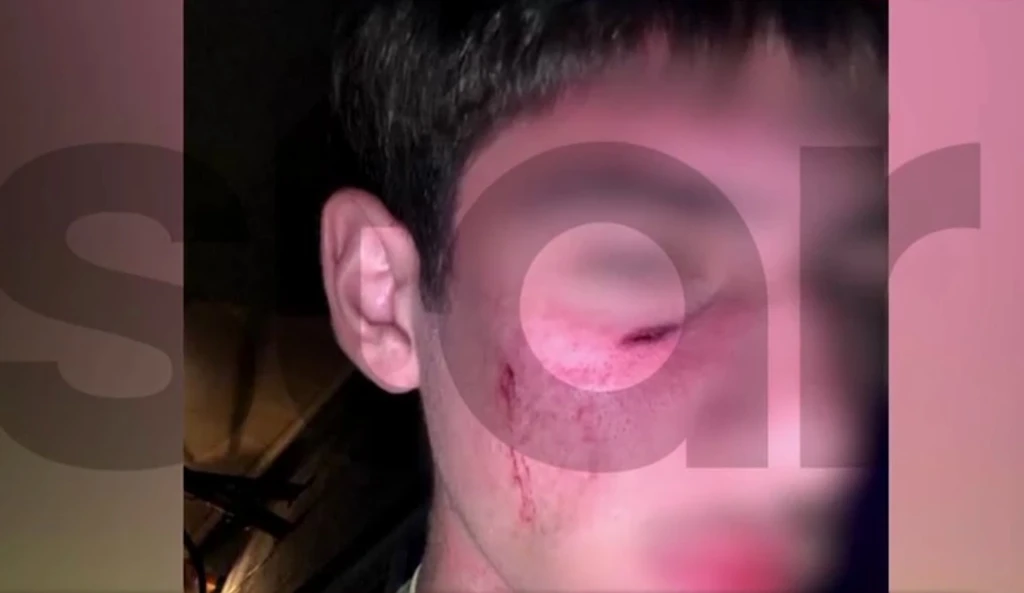 16-Year-Old Boy Hospitalized After Attack at Trikala Festival