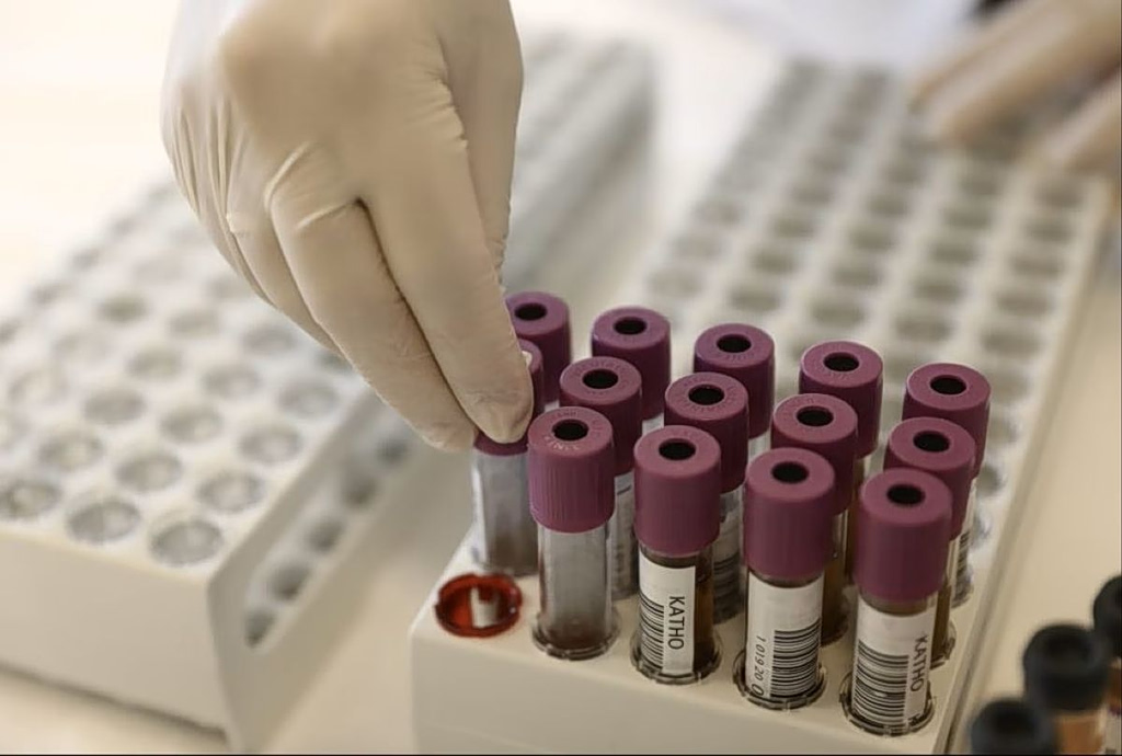 Stress Leaves a Measurable Mark on the Blood, Study Finds