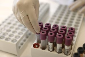 Stress Leaves a Measurable Mark on the Blood, Study Finds
