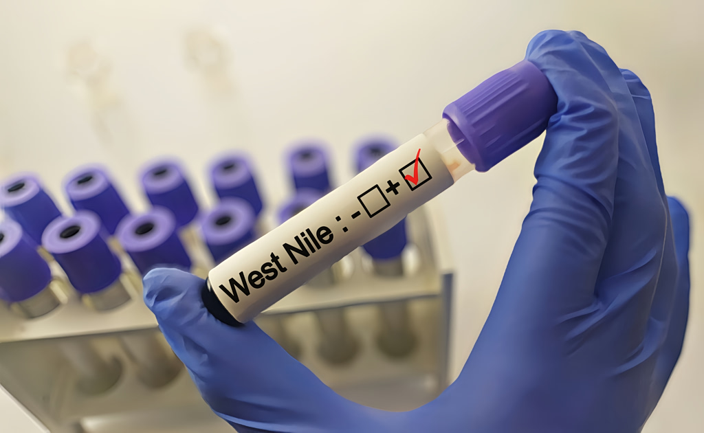 West Nile Virus Cases Rise Across Athens Region