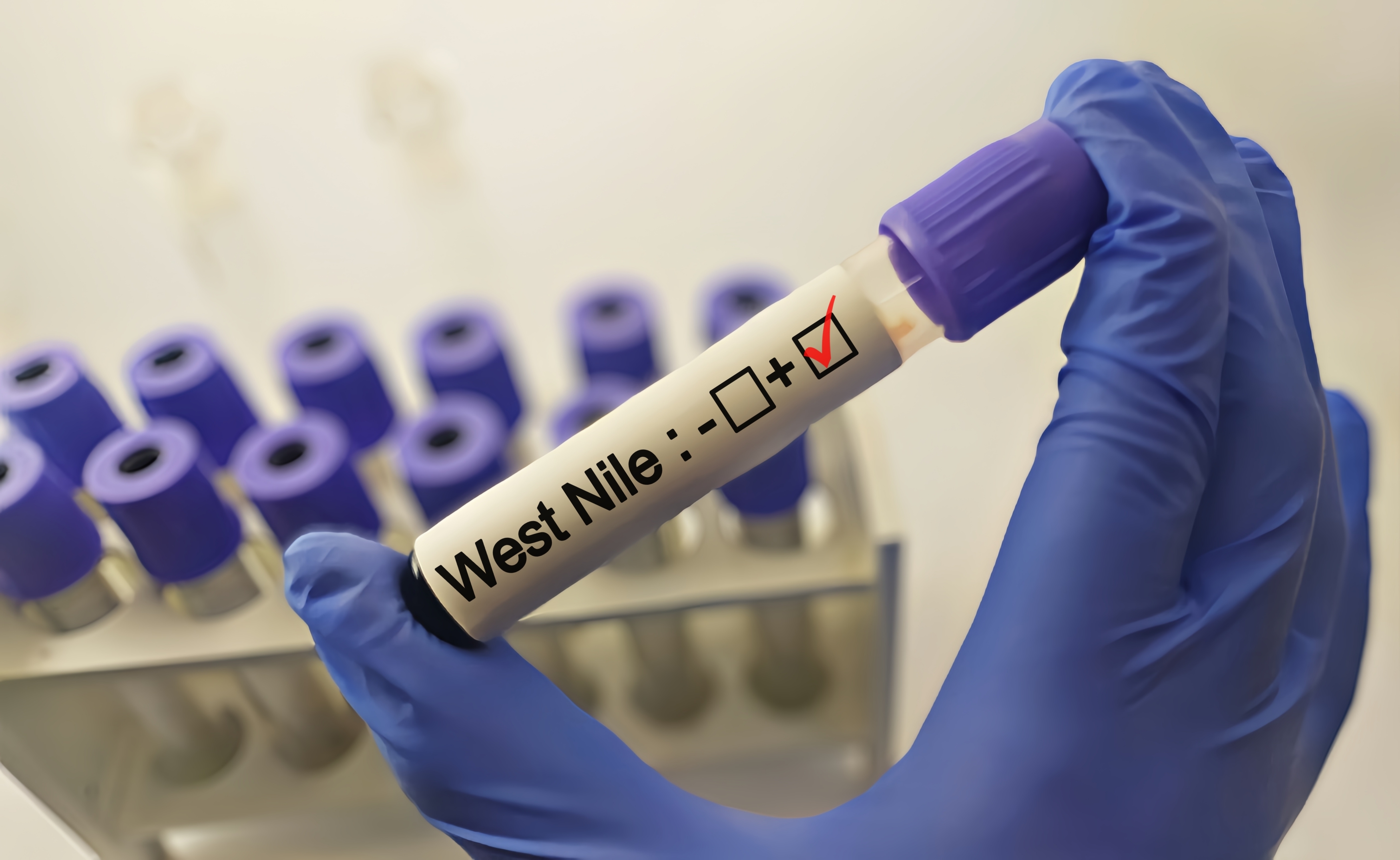 West Nile Virus Cases Rise Across Athens Region