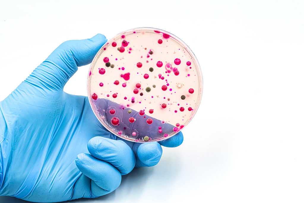 Sexually Transmitted Infections Surge Across Europe