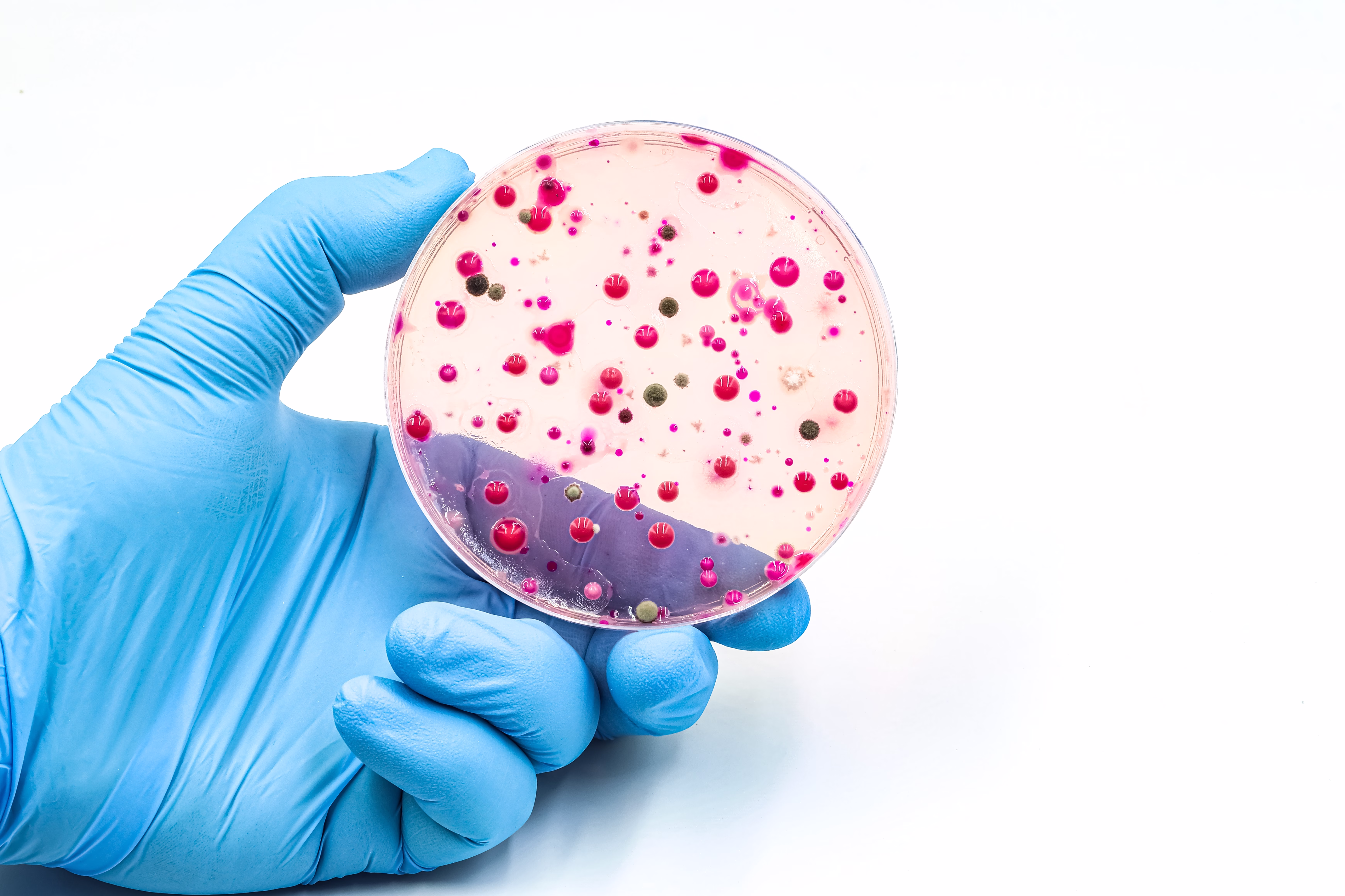 Sexually Transmitted Infections Surge Across Europe