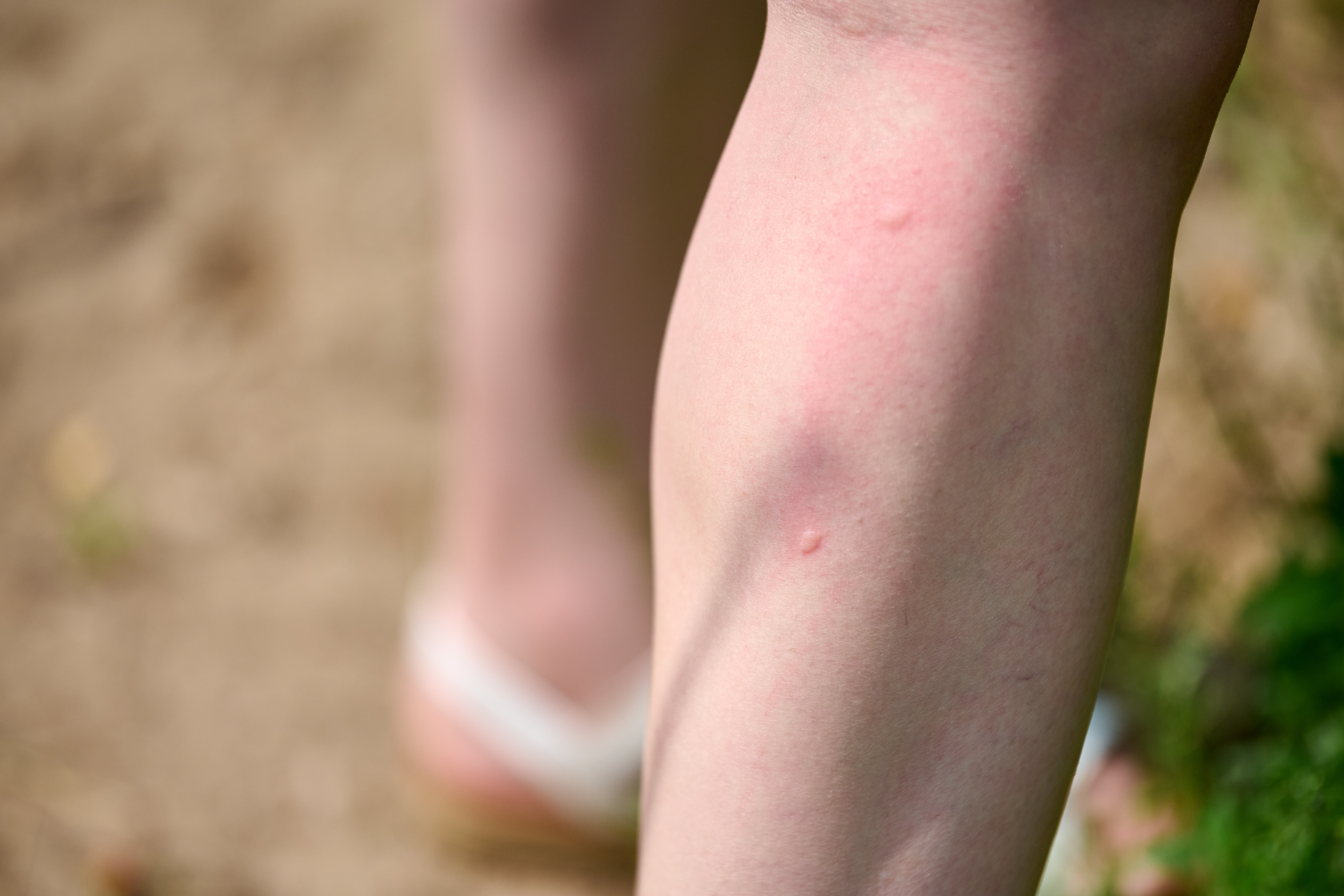 Greece Reports 110 West Nile Virus Cases and 9 Deaths