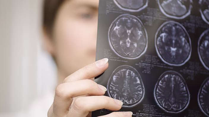 AI Is Helping Patients Solve Medical Mysteries