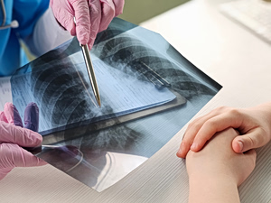 More Than 500,000 People Carry Cystic Fibrosis Gene in Greece