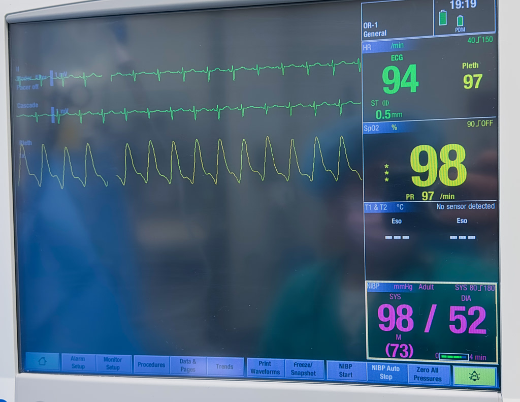AI Tool Detects Heart Disease in Under 2 Seconds, Study Finds