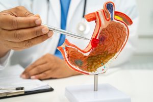 Stomach Cancer Risk More Than Doubles With Daily Sugary Drinks
