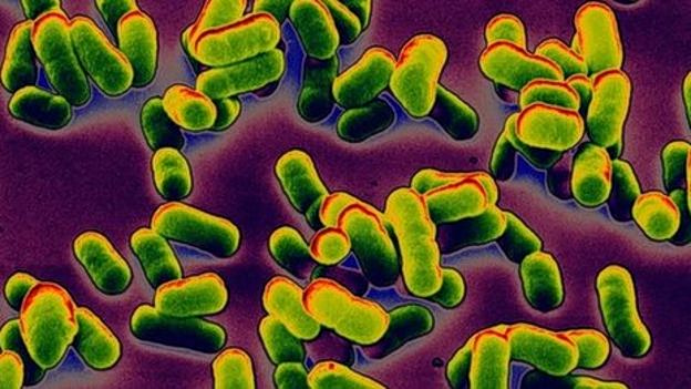 Russian Lab Worker’s Death Fuels Plague Fears in Siberia