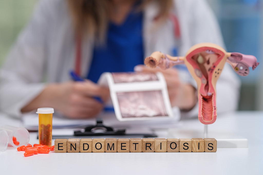New Endometriosis Drug Shows Promise in Mouse Study